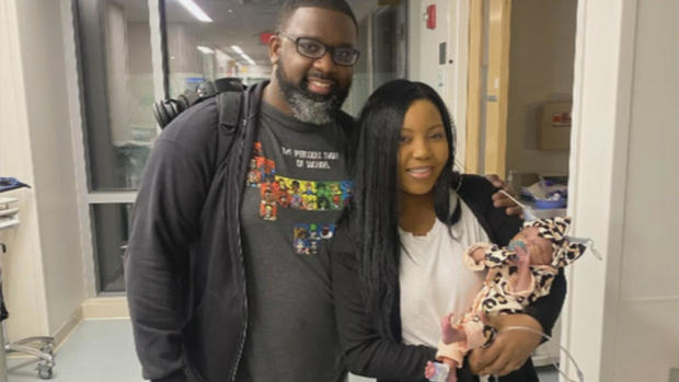 Derek, Kenyatta e Denver Coleman, pais do bebê que teve o cérebro operado no útero da mãe - Foto: CBS BOSTON