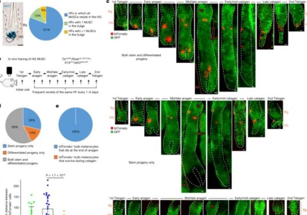 O estudo mostrou que os melanócitos vão ficando presos e impedem que a cor dos fios volte a crescer. - Foto: Reprodução/Nature