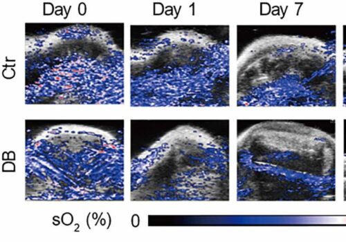 As imagens nos camundongos mostra que a bateria ataca as células cancerígenas de forma gradual. - Foto: Divulgação/Fudan University