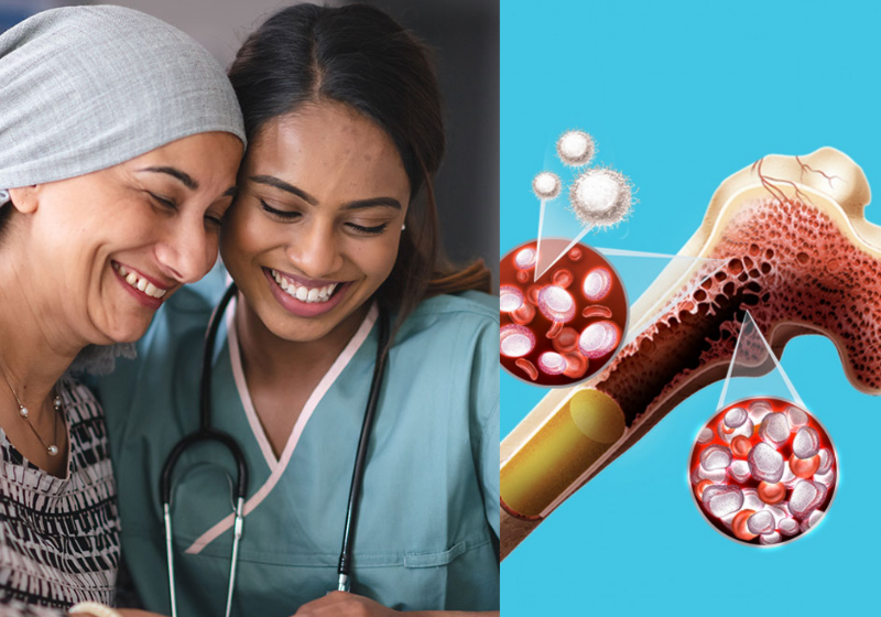 Com o sucesso do tratamento contra o câncer de medula óssea, que gerou remissão em 90% dos pacientes, o grupo agora quer expandir a técnica para outros tipos de câncer. - Foto: Reprodução/Sciath e Oncos.