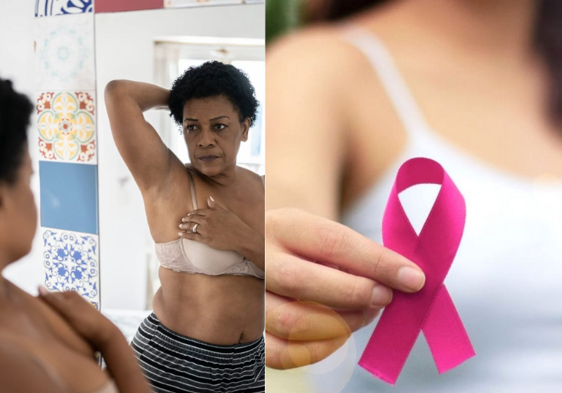 Com o avanço dos estudos, a ciência chega cada vez mais perto de um tratamento para o câncer de mama sem quimioterapia. Foto: Reprodução/Getty Images e Prefeitura de Itapira.