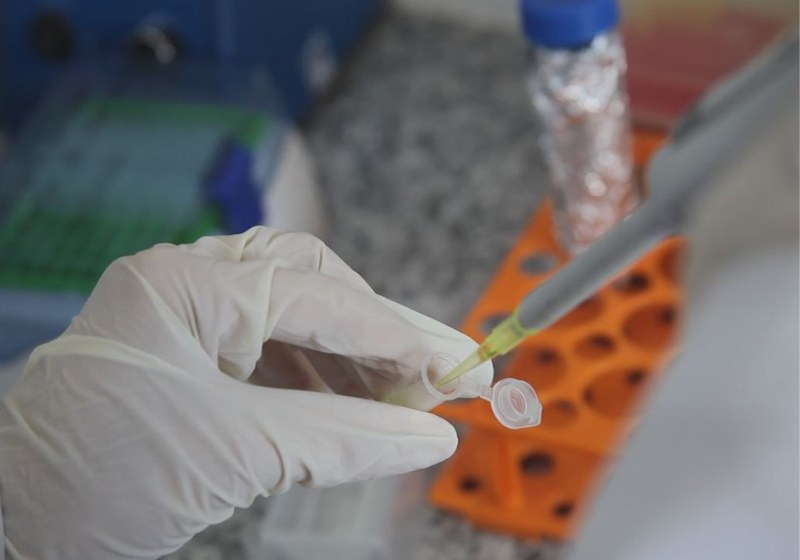 Agora com a parceria entre a UFMG e a prefeitura de São Paulo, a vacina brasileira contra cocaína e crack poderá ser testada em humanos - Foto: Reprodução/UFMG.