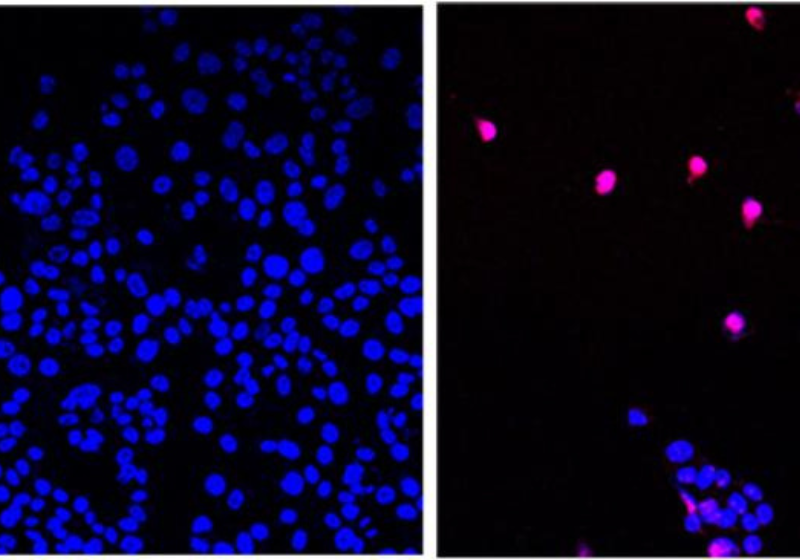 Na esquerda é possível ver células cancerígenas não tratadas. Já na direita, células tratadas com o AOH1996. Foto: Reprodução/City of Hope.