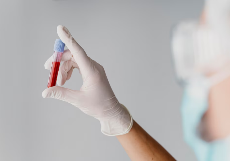 O exame de sangue para identificar o Alzheimer já está disponível no Brasil e o resultado sai em 20 dias. - Foto: Reprodução/Freepik.