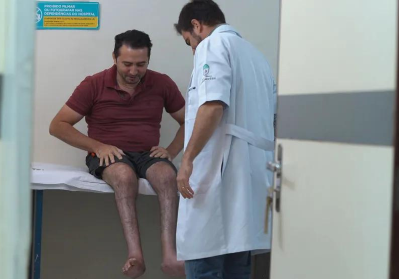A técnica aplicada do SUS envolve imobilização do gesso para fazer com que pacientes possam andar novamente. Foto: Reprodução/TV Globo.
