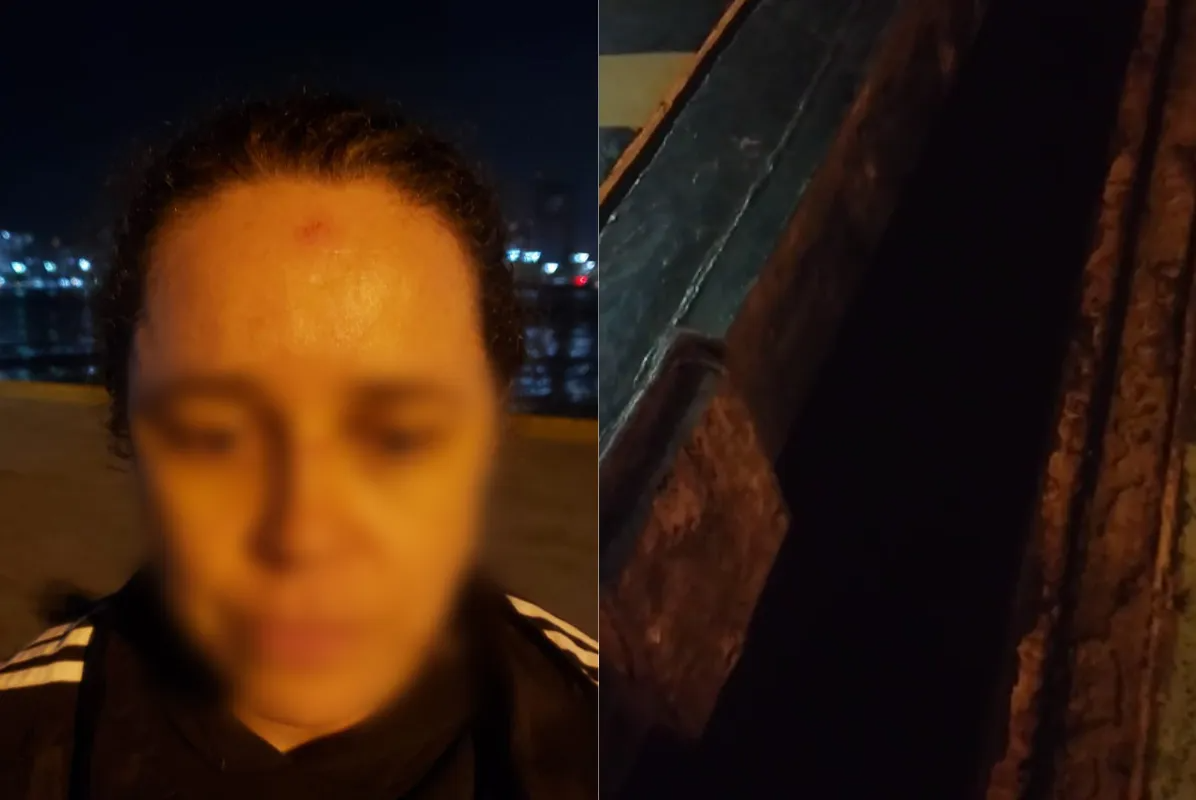 Vivian teve machucados pelo todo corpo e o pior só não aconteceu porque Agamenon estava próximo ao local. Foto: Reprodução/Arquivo pessoal.