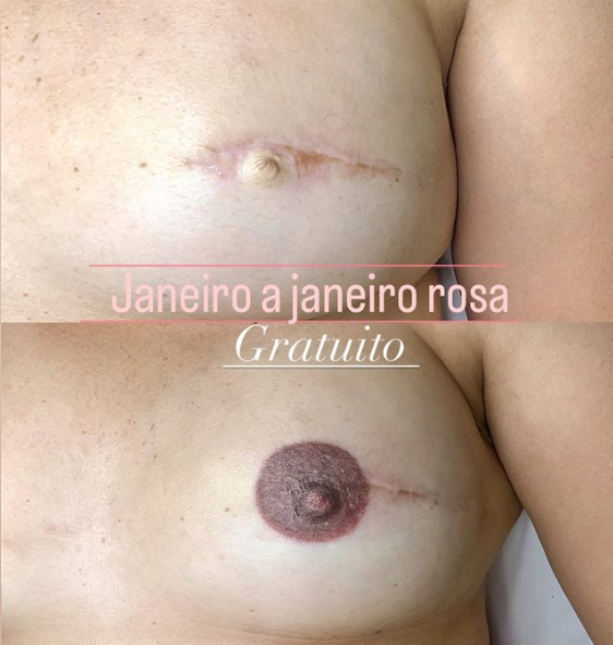 Ana Paula já reconstruiu a mama de 40 mulheres. Foto: Reprodução/@paulaacbeauty/Instagram.