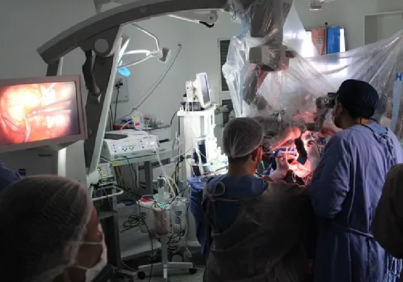 Durante a cirurgia de 10 horas para retirada de um tumor no cérebro, a paciente ficou acordada, leu e fez cálculos de matemática na Bahia. - Foto: ASCOM/HGCA