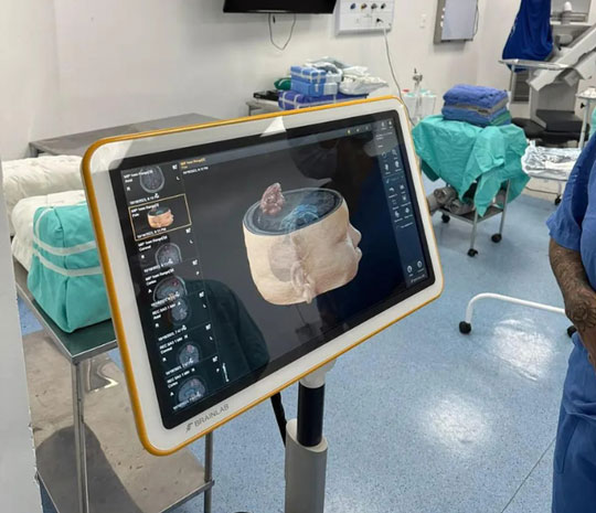 Médicos fazem a cirurgia com a paciente acordada para retirar tumor do cérebro e não prejudicar os movimentos dela após a operação - Foto: ASCOM/HGCA