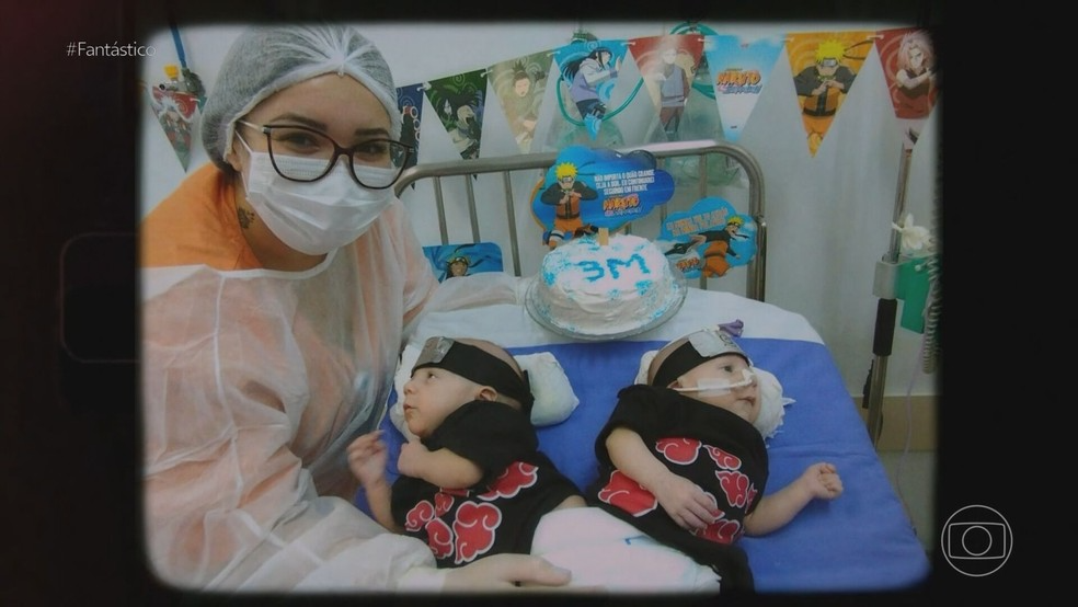 Jairo e Gabriel nasceram unidos pelo bumbum, e depois de uma cirurgia de 19 horas foram separados. Foto: Reprodução/TV Globo.