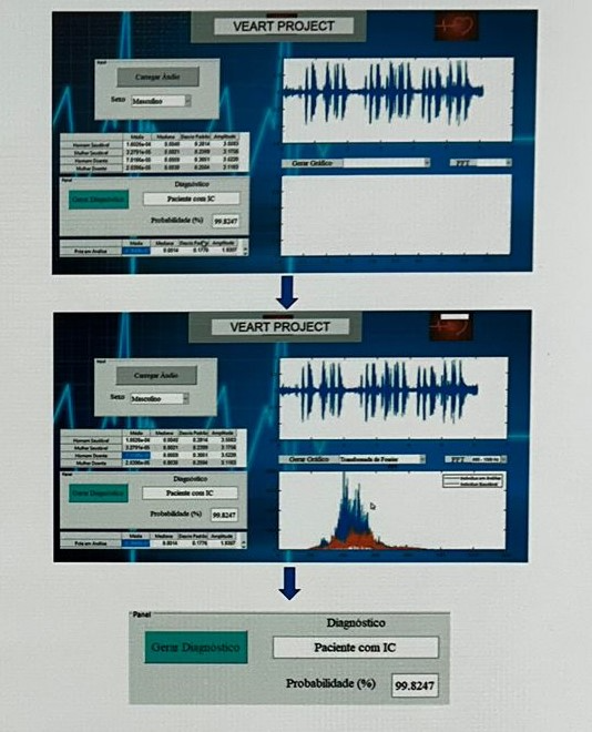 Os pesquisadores usaram a voz dos pacientes para identificar a existência do distúrbio. Foto: Arquivo pessoal dos cientistas.
