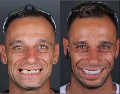 Antes e depois de Douglas. - Foto: reprodução/ Instagram @drviotto