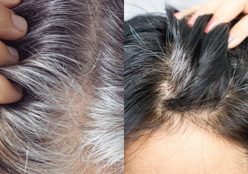 A Loção Escurecedora brasileira que reverte cabelos brancos é a Gradual Color – Drone Grey Over. Ela atua direto na reativação da produção de melanina – Foto: Divulgação