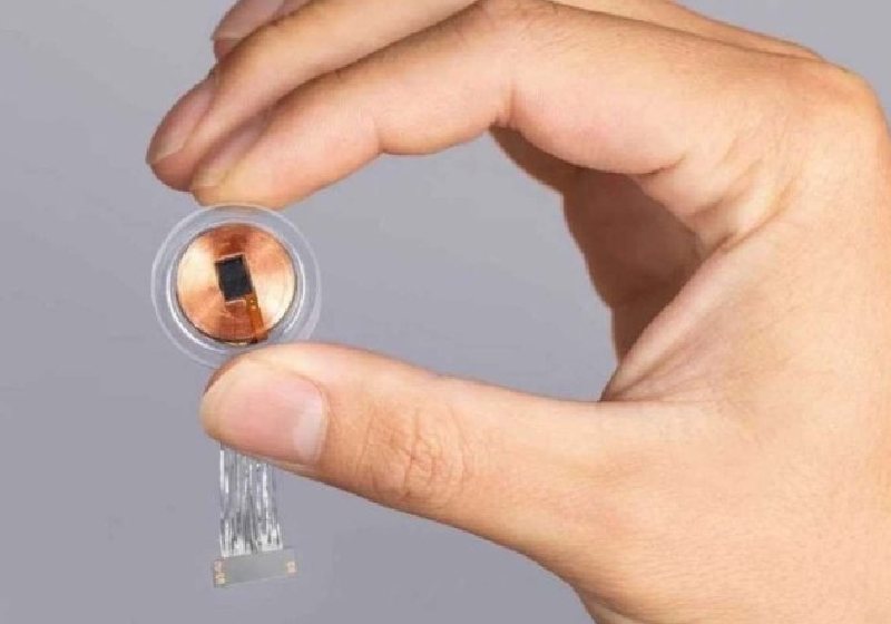 O chip cerebral de Elon Musk foi testado em macacos e agora em um ser humano, com sucesso, segundo o bilionário informou nas redes sociais. - Foto: Divulgação / Neuralink