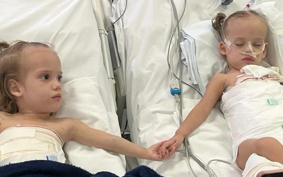 A cirurgia de separação das gêmeas durou quase 10 horas e teve a participação de 200 profissionais. - Foto: Divulgação/Zacharias Calil