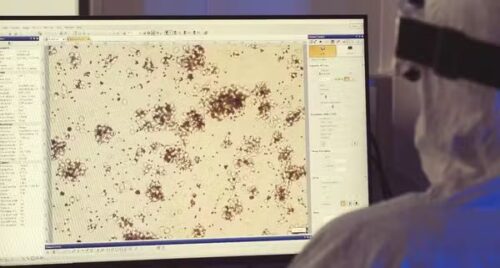 Os resultados do tratamento contra câncer CART-T tem impressionado médicos e pacientes - Foto: reprodução / TV Globo