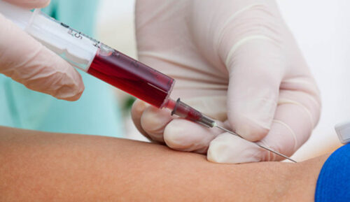 O exame é feito a partir da avaliação sanguínea e examina modificações no DNA. - Foto: Pixabay