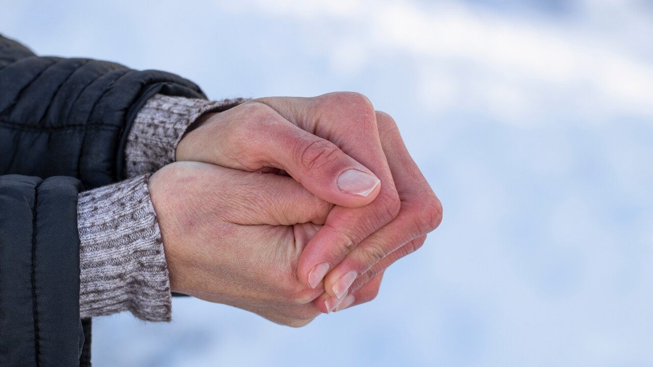 O iloprost será usado em casos de amputação por congelamento. Foto: WXYZ.