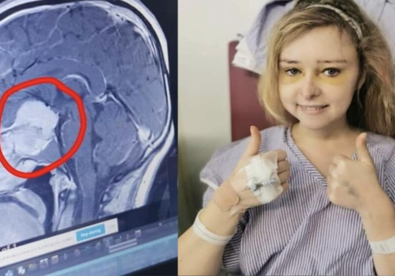 Após o exame de rotina no olho, os profissionais conseguiram identificar o tumor no cérebro da mulher e ela foi salva. - Foto: Katie Everett.