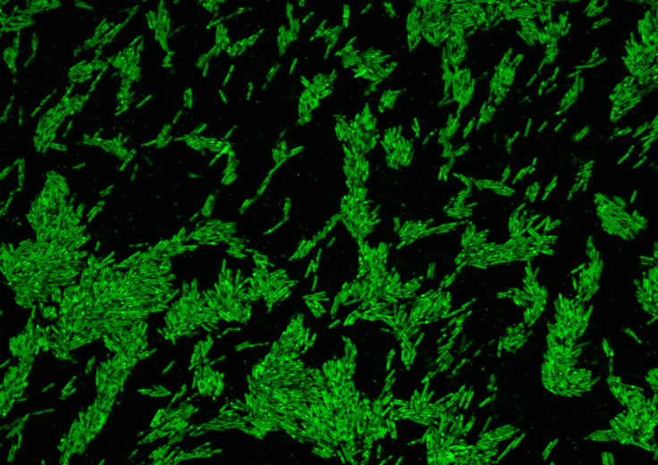 As Oscillibacter absorvem o colesterol, que depois é excretado do corpo. Foto: Ahmed Mohamed.