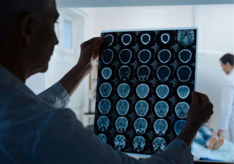 Estudos mostraram que o tratamento produziu bem menos efeitos colaterais. Foto: Dmytro Zinkevych/Alamy.