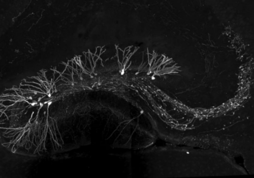 Imagem mostra que exercícios e atividades físicas estimuladas pela luz ajudam a criar neurônios no hipocampo cerebral, que crescem rapidamente e mostram ramificações. (Crédito:Paul Frankland; Universidade de Toronto)