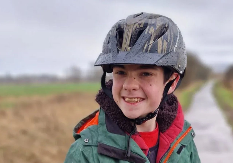 O menino Oran foi o primeiro do mundo a receber um implante contra epilepsia. As convulsões diárias dele reduziram em 80%. -Foto: Great Ormond Street Hospital For Children.