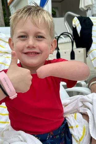 Jordan antes de receber o braço biônico. - Foto: arquivo pessoal