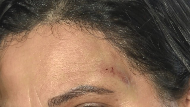 A mulher foi agredida com golpes de capacete. Foto: TV Gazeta.