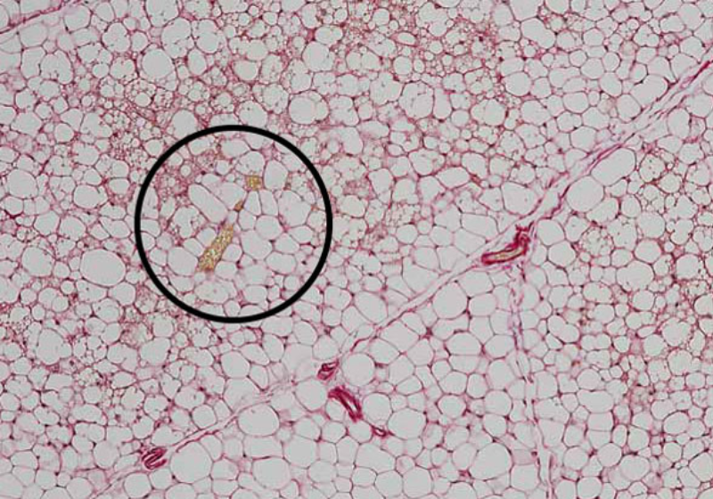 Na foto, célula branca transformada em bege pelos pesquisadores da Universidade da Califórnia em São Francisco, nos Estados Unidos. - Foto: UCSF.