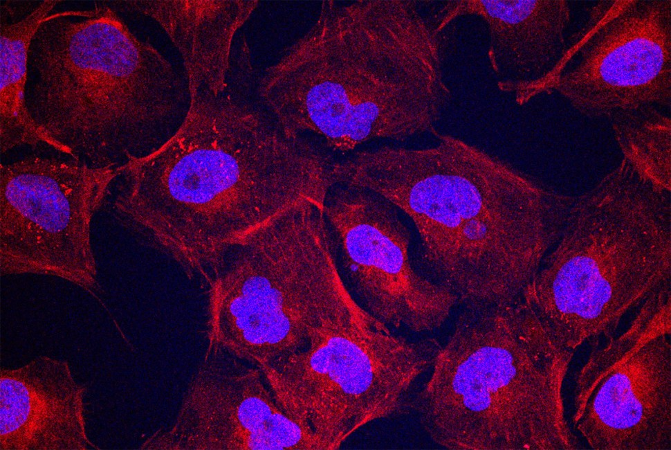 As moléculas dançantes apresentaram resultados incríveis na regeneração da cartilagem. Foto: Freepik.