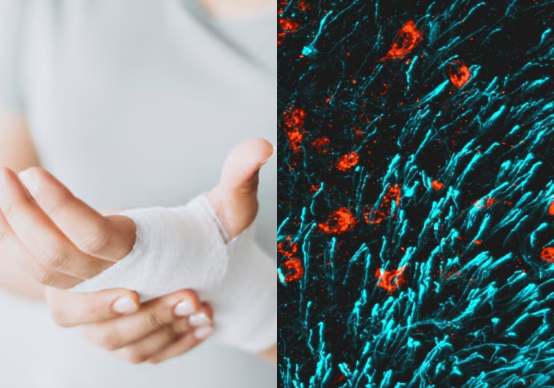 O hormônio descoberto pode ajudar a curar fraturas e até mesmo a osteoporose. Foto: Freepik/Laboratório Ingraham/UCSF.