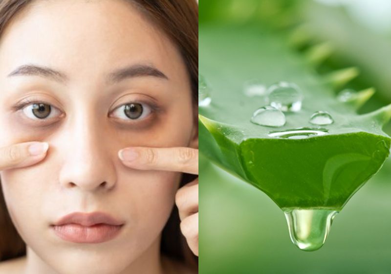 O portal Healthline divulgou uma pesquisa que mostra os efeitos positivos da aloe vera, a babosa, para reduzir as olheiras. - Fotos: Shutterstock