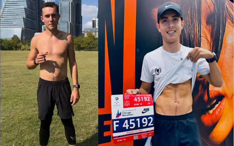 Thiago Quint Santos é um brasileiro cheio de garra: venceu o câncer e agora correu a Maratona de Chicago. Em um vídeo, mostra as marcas do tratamento: cicatrizes e desgastes. Mas está feliz. - Foto: @thiagoquintsantos