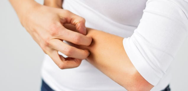 Apesar dos benefícios, é preciso ter equilíbrio. Se coçar demais pode trazer danos a pele. - Foto: Kaspars Grinvalds/Shutterstock