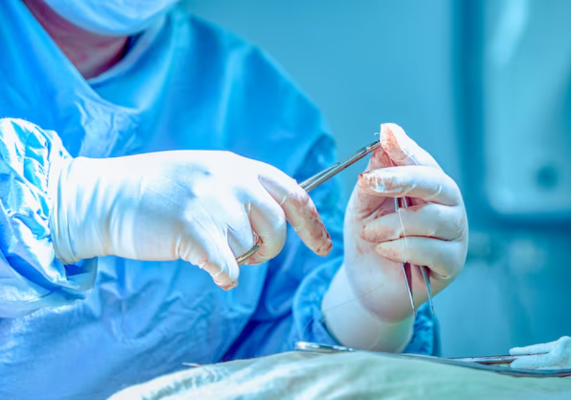 A cirurgia cerebral para tratar obesidade por enquanto é experimental e não está disponível no SUS. Foto: Freepik