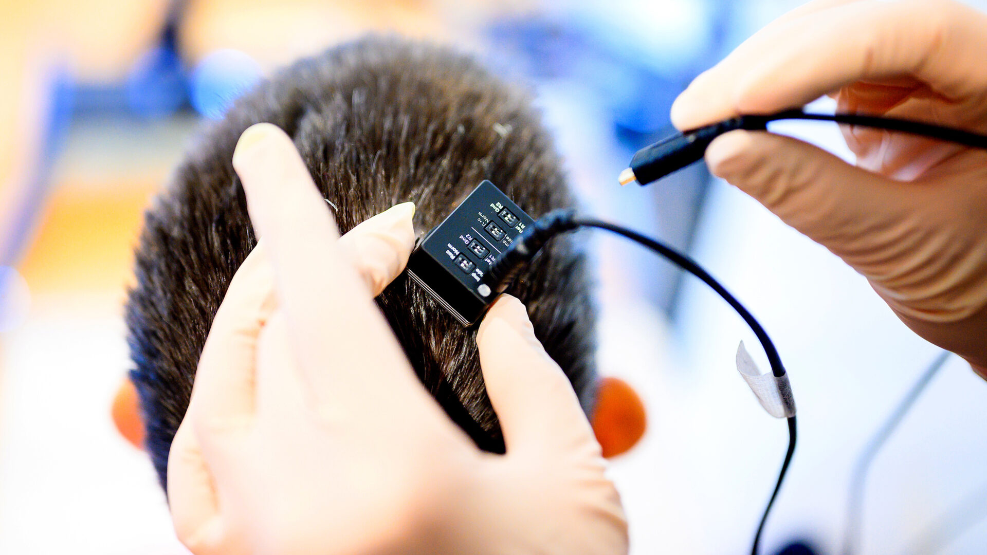 Os pesquisadores conectaram um plante cerebral ao computador sintetizador de voz. - Foto: Noah Berger