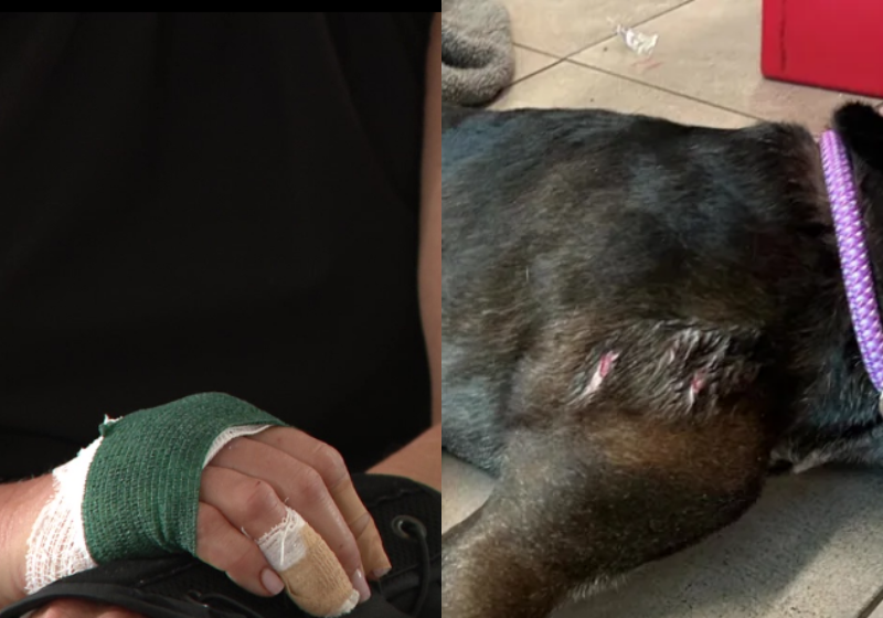 A mulher e a cachorrinha acabaram feridas pelo jacaré. - Foto: Fox 13