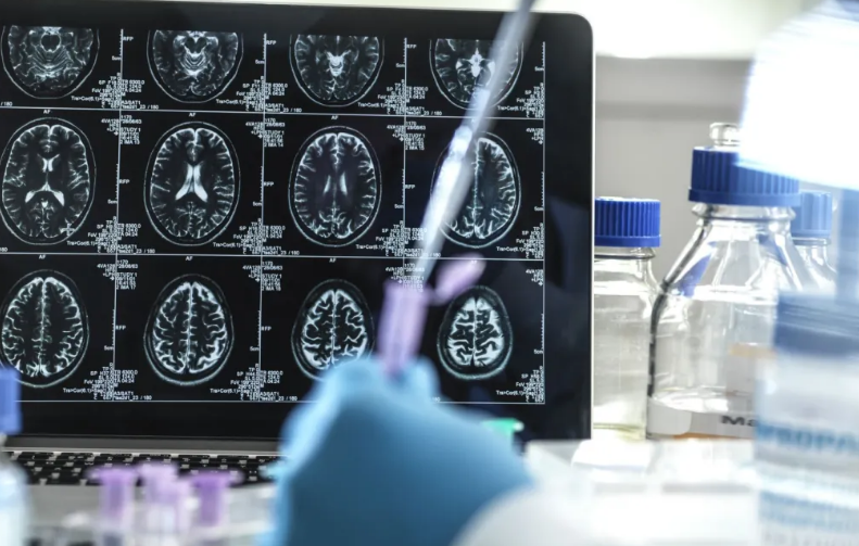 O medicamento é injetável e deve ser administrado uma vez por mês. - Foto: Getty Images/Science Photo Libra