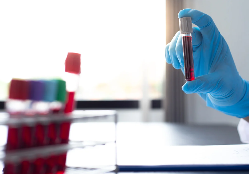 O sangue artificial trouxe esperança para médicos do mundo inteiro. Hoje, a falta de bolsas para transfusão é um dos agravantes em hospitais. - Foto: Canva