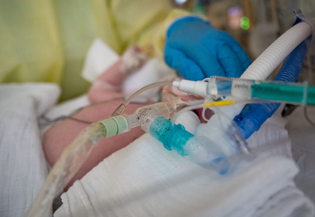 A internação caiu em 52% nos Estados Unidos. - Foto: Getty Images