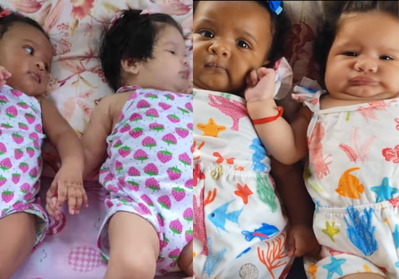 As gêmeas brasileiras de cores diferentes, um caso raro na ciência, chamam a atenção nas ruas de São Luís, no MA. Divas aos 4 meses, Maryelle e Myalla são fofas! . Foto: @laiannysantos_