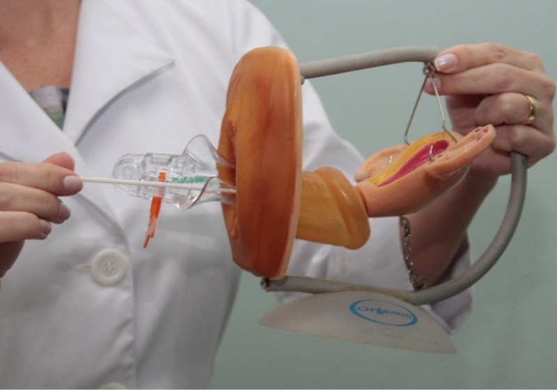 O Teal Health (feito com empatia) é menos invasivo do que o Papanicolau também ser um autoexame, a própria mulher coleta o material, no caso dos EUA, ela poderá enviar pelo Correio. Foto: Cofen