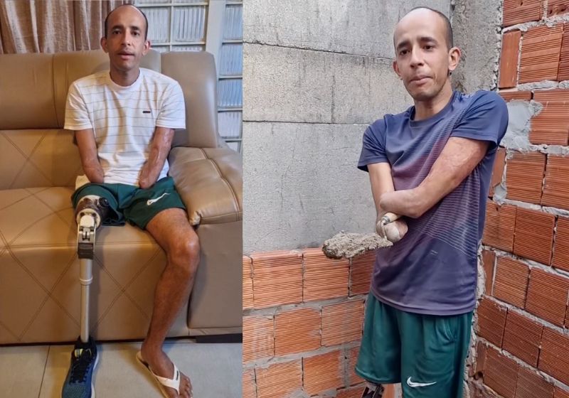 A superação do Cleber, um pai de família que perdeu as duas mãos e uma perna após um choque elétrico, e hoje está construindo a própria casa e precisa de próteses. Vamos ajudar?. - Foto: reprodução redes sociais