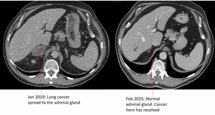Jeff hoje leva uma vida completamente normal. O câncer sumiu totalmente. - Foto: SWNS