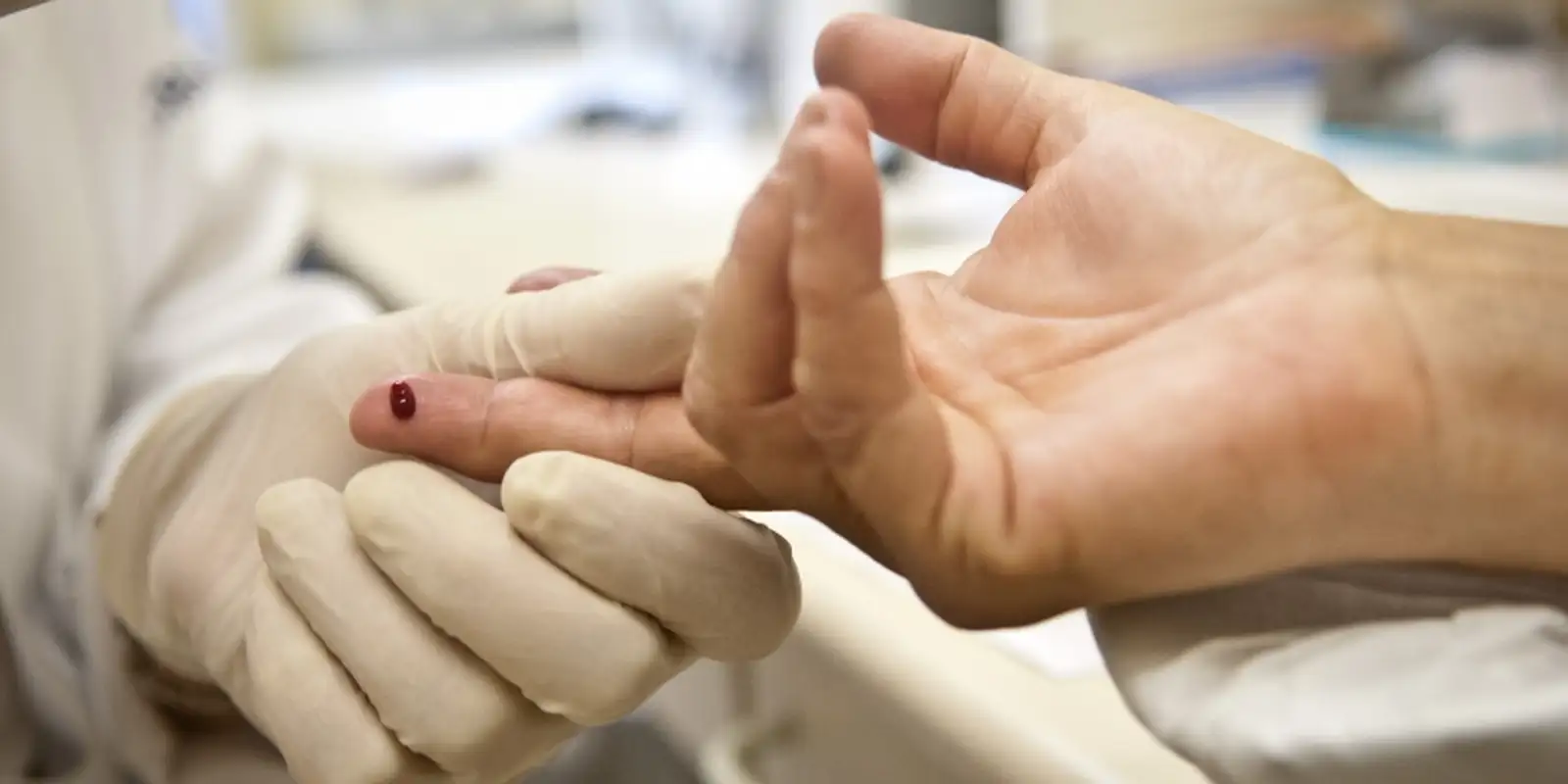 Apesar da notícia boa dos cientistas da Austrália sobre o HIV  foi publicada na revista Nature Communications. - Foto: Agência Brasil