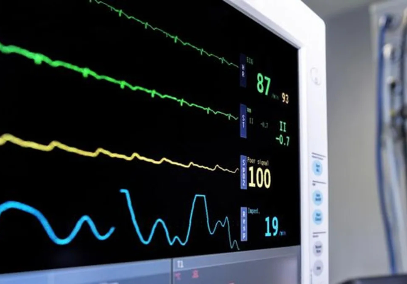 O microscópio com inteligência artificial (IA), de Tóquio, ajuda a prevenir AVC e infarto. - Foto: Getty Images