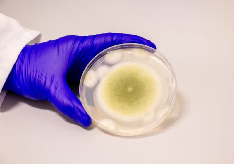 O Aspergillus flavus é um fungo tóxico que pode ajudar a tratar a leucemia, descobriram pesquisadores da Universidade da Pensilvânia (EUA). - Foto: Bella Ciervo