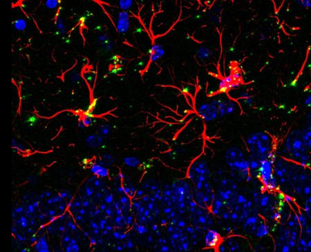 Os astrócitos, em vermelho, têm um papel decisivo sobre doenças neurodegenerativas. - Foto: Felipe Cabral-Miranda e Ana Paula Bergamo Araujo