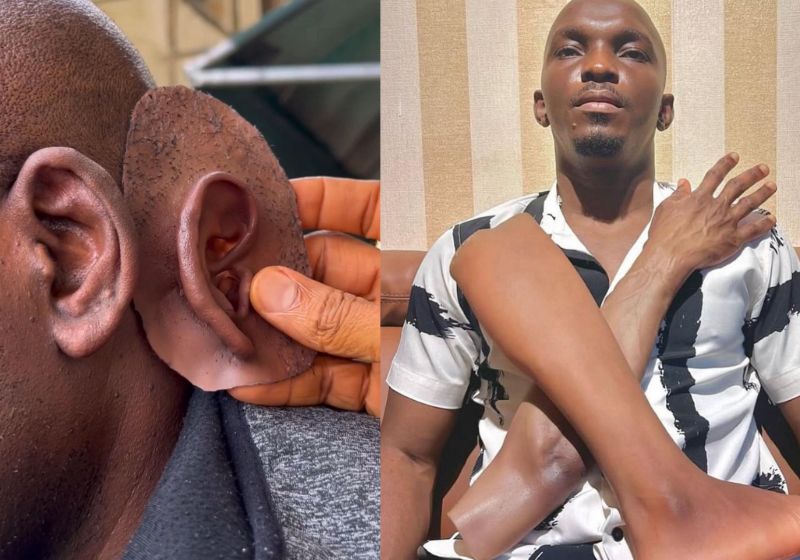 John Amanam, artista da Nigéria que faz próteses realistas para pessoas pretas, teve a ideia depois que uma pessoa da família perdeu um dedo e não havia nada na cor dela. - Foto: @john_amanam